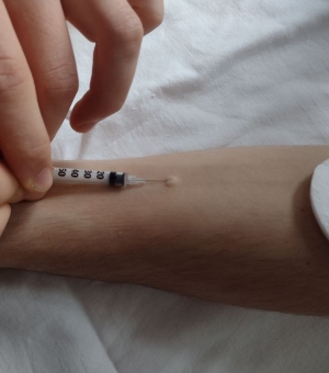 Студенти групи 4М 9/1 опановують методику проведення туберкулінодіагностики та 